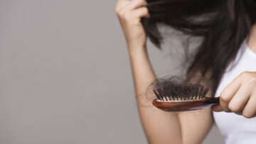 Haarausfall stoppen – die besten Mittel